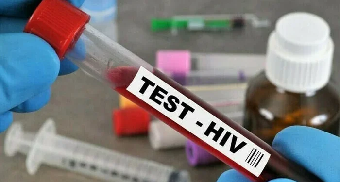 فلپائن میں ایچ آئی وی کے کیسز 500 فیصد بڑھ گئے، طبی ہنگامی حالت نافذ