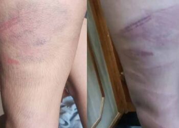 راولپنڈی: سبق یاد نہ کرنے پر نجی اسکول کے استاد کا طالب علم پر بدترین تشدد، جسم پر نشانات پڑ گئے